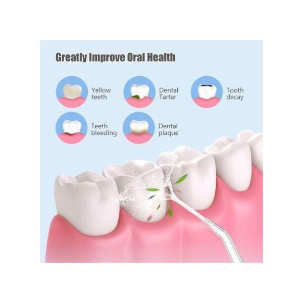 dental water flosser